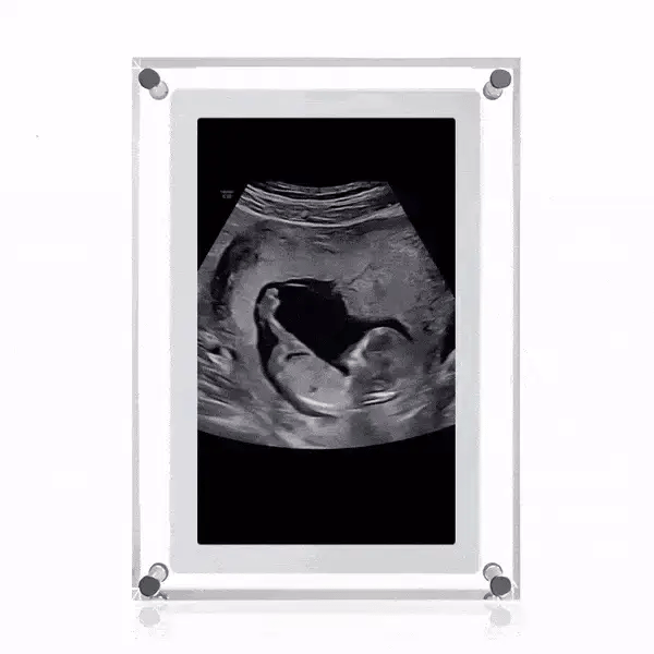EverKeep™ Digital Frame