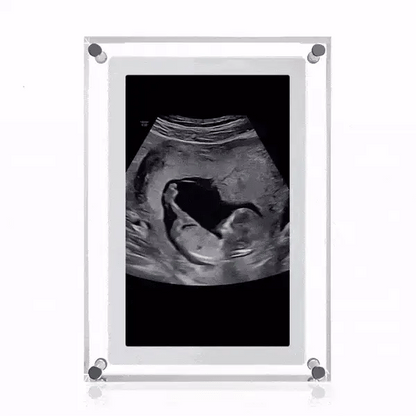 EverKeep™ Digital Frame