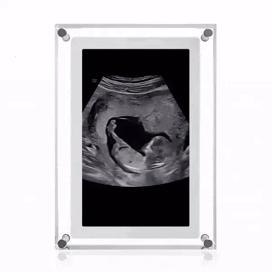 EverKeep™ Digital Frame
